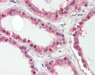 UXT Antibody in Immunohistochemistry (Paraffin) (IHC (P))