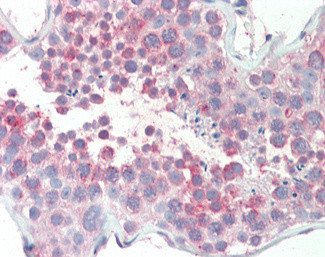 MARCH10 Antibody in Immunohistochemistry (Paraffin) (IHC (P))