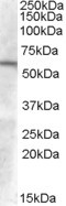 GCNT3 Antibody in Western Blot (WB)