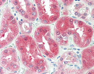 BDH2 Antibody in Immunohistochemistry (Paraffin) (IHC (P))