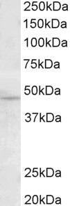 TMPRSS4 Antibody in Western Blot (WB)