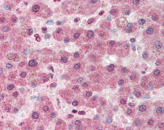 Pyruvate Carboxylase Antibody in Immunohistochemistry (Paraffin) (IHC (P))