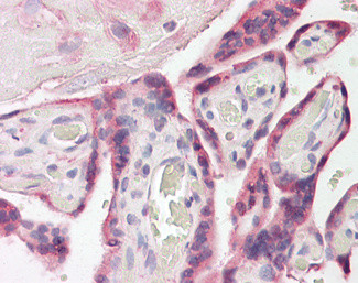 FAM62A Antibody in Immunohistochemistry (Paraffin) (IHC (P))