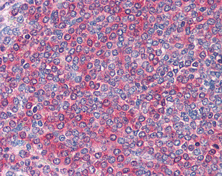 FZD7 Antibody in Immunohistochemistry (Paraffin) (IHC (P))