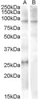 APOBEC2 Antibody in Western Blot (WB)