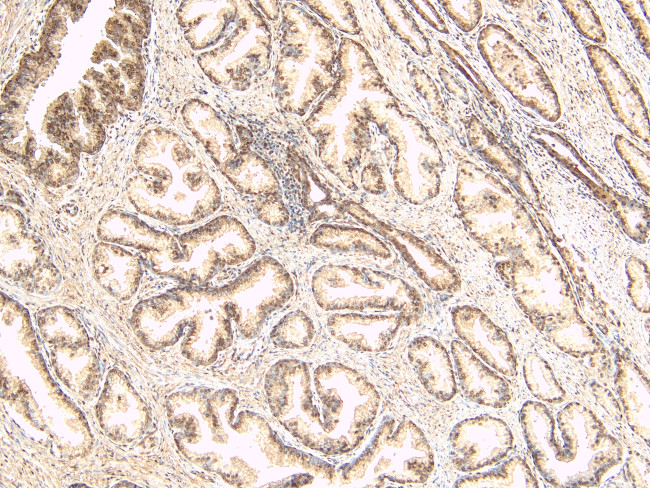 TUSC3 Antibody in Immunohistochemistry (Paraffin) (IHC (P))