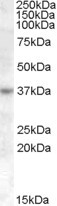 RASSF7 Antibody in Western Blot (WB)