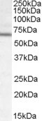DACH2 Antibody in Western Blot (WB)