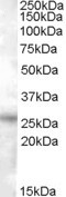 RASSF3 Antibody in Western Blot (WB)