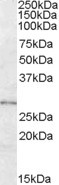LYPLAL1 Antibody in Western Blot (WB)