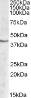 SPHK1 Antibody in Western Blot (WB)
