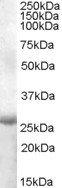 APOBEC2 Antibody in Western Blot (WB)