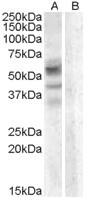 Arylsulfatase D Antibody in Western Blot (WB)
