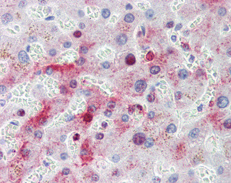 MTHFD1 Antibody in Immunohistochemistry (Paraffin) (IHC (P))