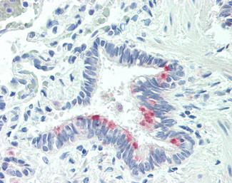 MTHFS Antibody in Immunohistochemistry (Paraffin) (IHC (P))