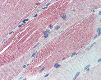 IGFBP6 Antibody in Immunohistochemistry (Paraffin) (IHC (P))