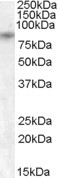 TRPV5 Antibody in Western Blot (WB)