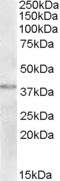TXNDC6 Antibody in Western Blot (WB)