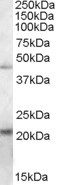ERP44 Antibody in Western Blot (WB)