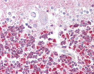 EPM2A Antibody in Immunohistochemistry (Paraffin) (IHC (P))