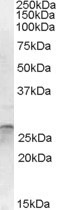 OTUB2 Antibody in Western Blot (WB)