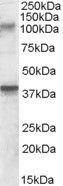 GluR7 Antibody in Western Blot (WB)