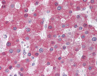 MRP5 Antibody in Immunohistochemistry (Paraffin) (IHC (P))