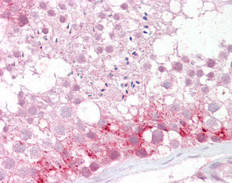 PMP70 Antibody in Immunohistochemistry (Paraffin) (IHC (P))