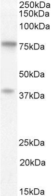 ZRANB1 Antibody in Western Blot (WB)