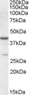 CBX8 Antibody in Western Blot (WB)