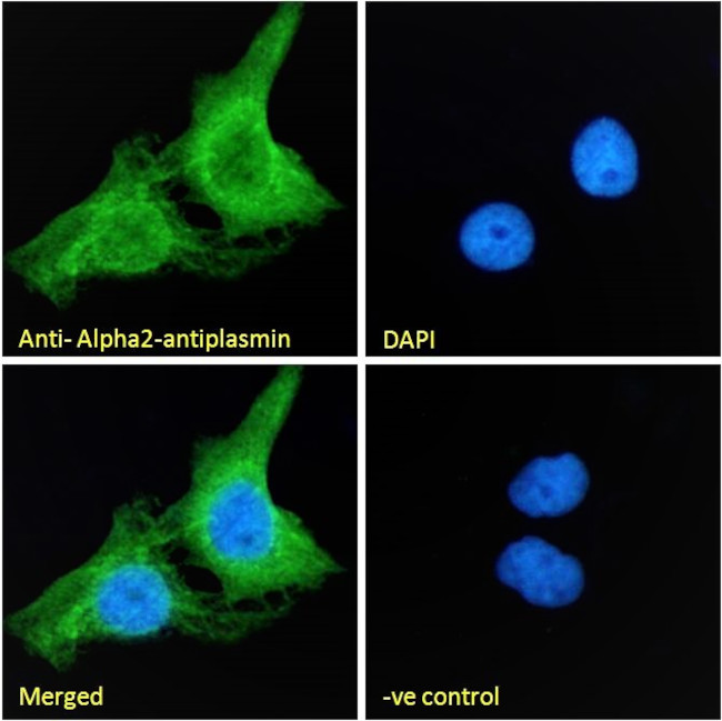 SERPINF2 Antibody in Immunocytochemistry (ICC/IF)