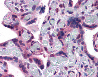 TRPC4 Antibody in Immunohistochemistry (Paraffin) (IHC (P))