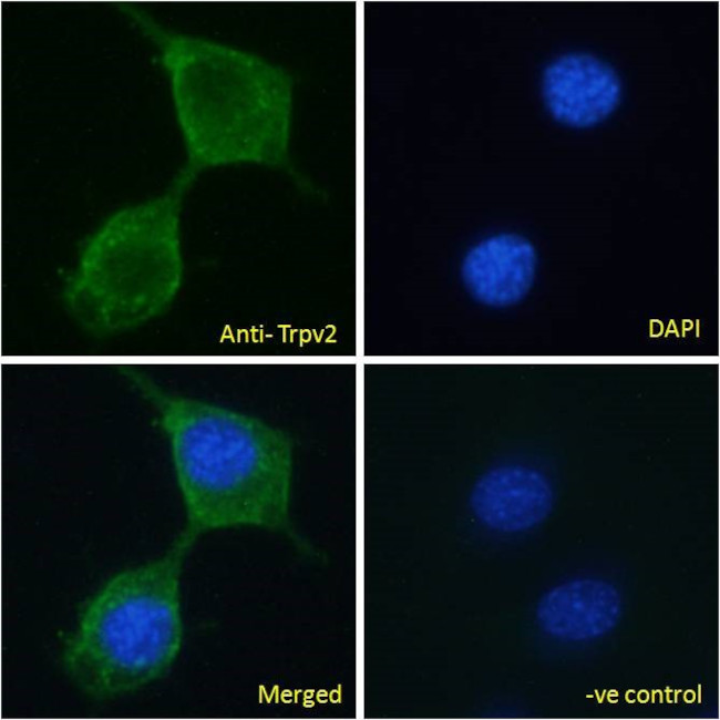 TRPV2 Antibody in Immunocytochemistry (ICC/IF)