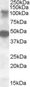 STK11IP Antibody in Western Blot (WB)