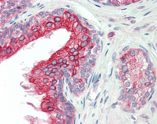 ANKK1 Antibody in Immunohistochemistry (Paraffin) (IHC (P))
