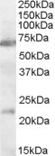 CHRNA4 Antibody in Western Blot (WB)