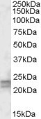 ARL4D Antibody in Western Blot (WB)