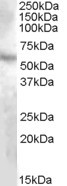 DMP1 Antibody in Western Blot (WB)