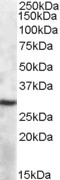 APOBEC1 Antibody in Western Blot (WB)