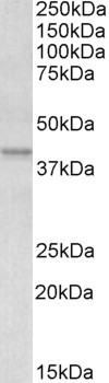 Apolipoprotein L1 Antibody in Western Blot (WB)