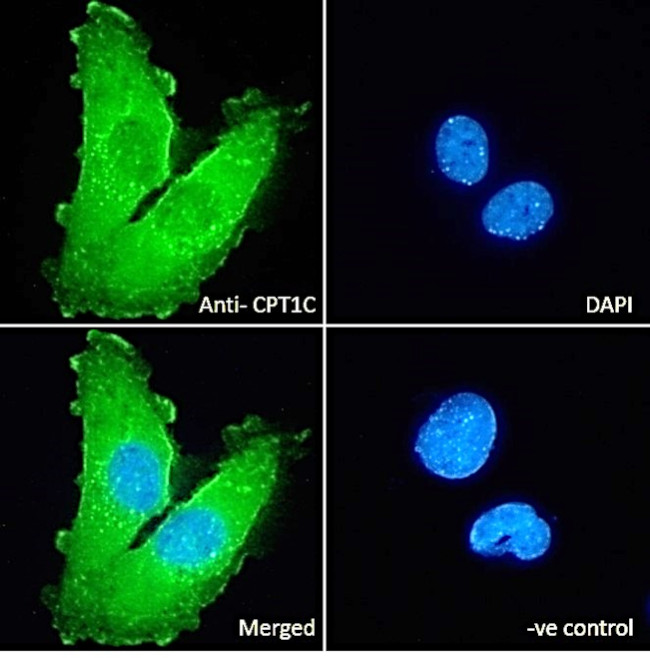 CPT1C Antibody in Immunocytochemistry (ICC/IF)