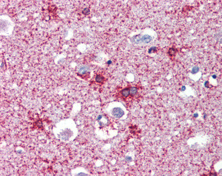 Septin 2 Antibody in Immunohistochemistry (Paraffin) (IHC (P))