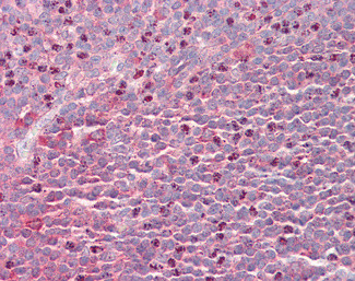 SEPT6 Antibody in Immunohistochemistry (Paraffin) (IHC (P))