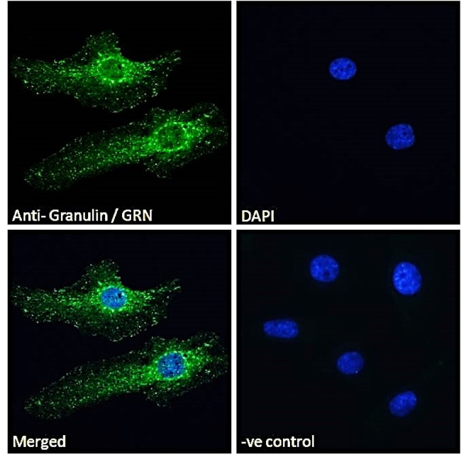 Granulins Antibody in Immunocytochemistry (ICC/IF)