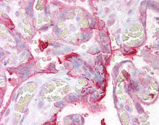 NCE2 Antibody in Immunohistochemistry (Paraffin) (IHC (P))