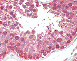 COG7 Antibody in Immunohistochemistry (Paraffin) (IHC (P))
