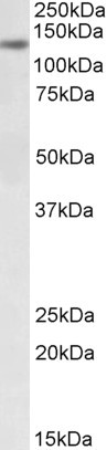 DIAPH1 Antibody in Western Blot (WB)