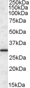ERP29 Antibody in Western Blot (WB)