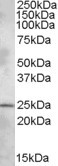 PHR1 Antibody in Western Blot (WB)