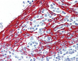 Cytokeratin 13 Antibody in Immunohistochemistry (Paraffin) (IHC (P))